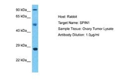 SPIN1 Rabbit anti-Human, Polyclonal, Novus Biologicals 0.1ml; Unconjugated:Antibodies,